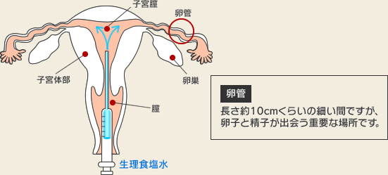 不妊治療 検査 静岡県沼津 三島 産婦人科 不妊治療の岩端医院