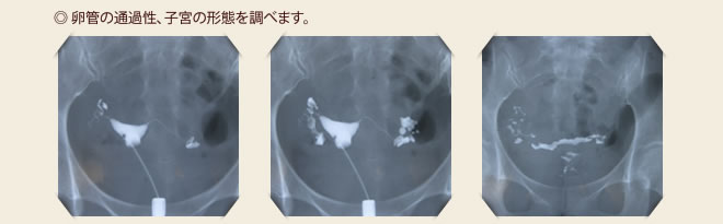 不妊治療 検査 静岡県沼津 三島 産婦人科 不妊治療の岩端医院